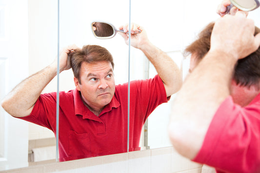 How to Deal with Male Pattern Hair Loss & Bald Spots
